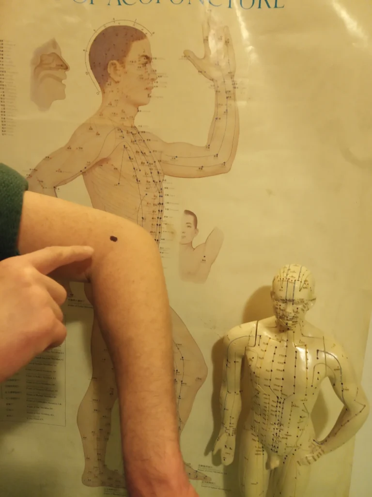 Qu Chi –punkt łagodzący nadciśnienie